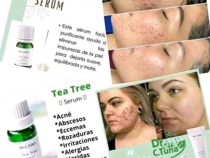 Suero de Tea tree de Farmasi
