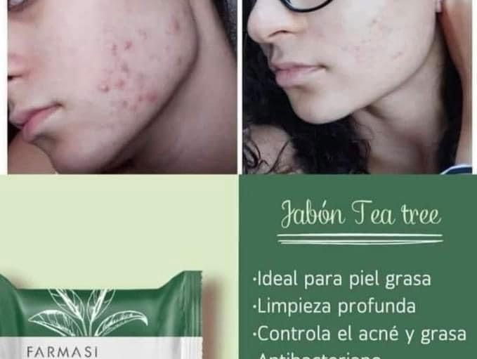 Jabón de extracto de árbol del té