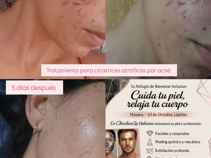 Tratamientos faciales y corporales, tu bienestar es mi prioridad